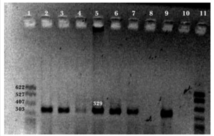 Figura 3. Resultados de la PCR positivos al fragmento 329 pb de SI  en un gel de agarosa teñido con bromuro de etidio
