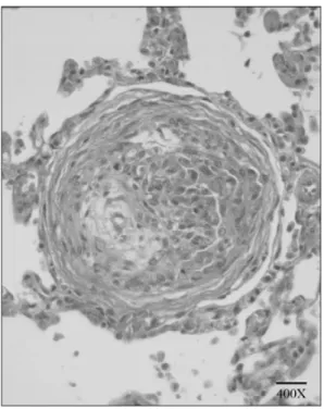 Figure 4. Lung microscopic image, which shows the detail of 