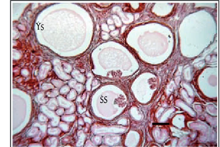 Figura 1:  Aspecto macroscópico del riñón de un perro Dálmata,  que muestra palidez y apariencia esponjosa con múltiples pequeños  quistes en la superfi cie renal
