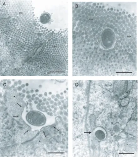 Figura 2:  Secuencia de la interacción bacteriana con  enterocitos de ciego,  de aves infectadas con SI a las 6  hpi