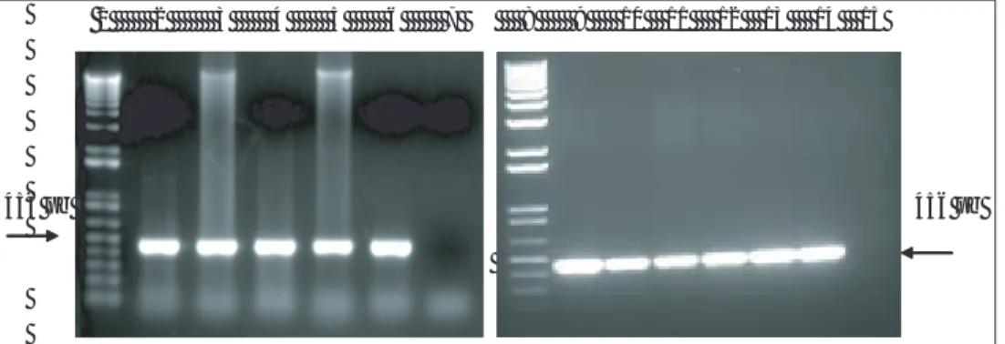 Figure 2:  1% Agarose gel in TAE stained with ethidium bromide which shows the products amplifi ed with PCR-2