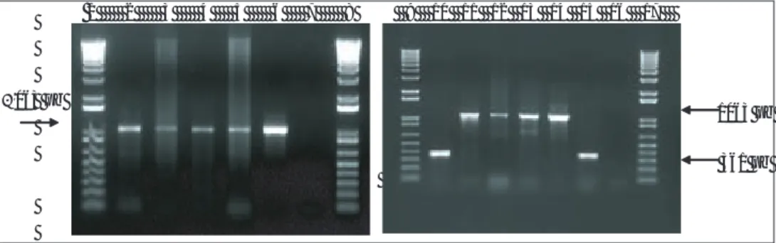 Figura 4 a y b:  Gel de agarosa al 1% en TAE teñido con bromuro de etidio en el que se separan los productos amplifi cados con la PCR-2 a partir 