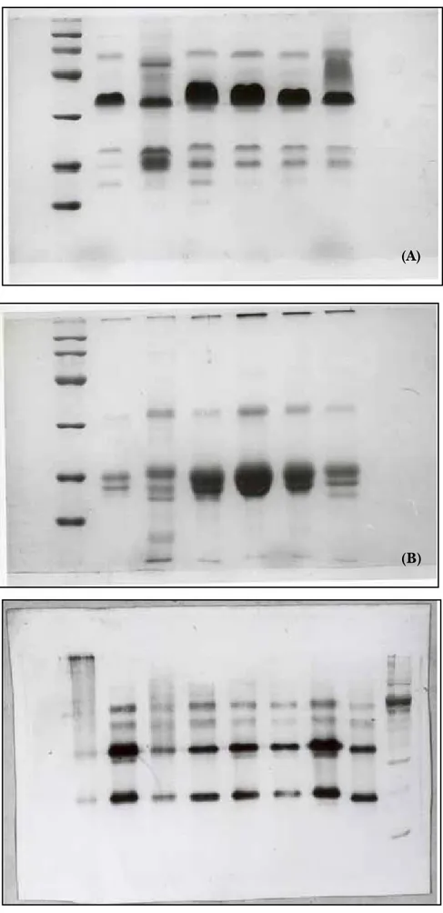 Figura 4. Electroforesis discontinua en 