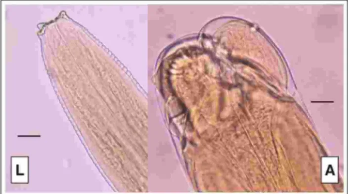 Figura 1. Región anterior de una larva L3 (L) y de un adulto 