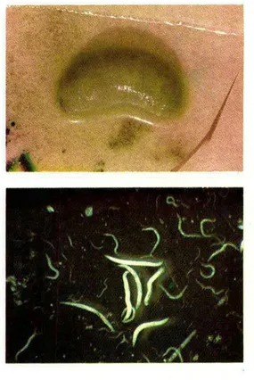 Fig. 2. Nematodo  Sie/nernema  sp.