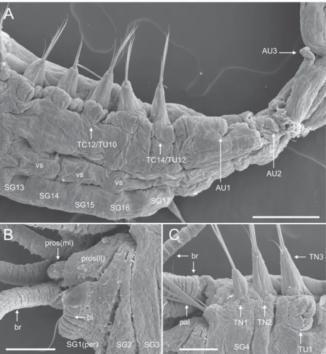 Fig. 5.  Ampharete  oculicirrata sp. nov., paratype MNCN 16.01/18482_spec. 3. A. Transitional area  between thorax and abdomen, ventral view