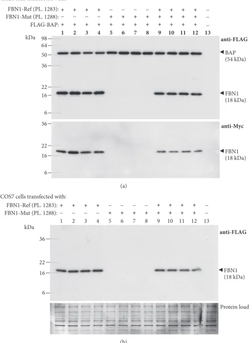Figure 3: Western blot analysis of minigene-derived proteins. (a) FLAG/Myc-tagged reference (FBN1-Ref) and mutant (FBN1-Mut) minigene plasmids (PL) were transfected into HeLa cells as indicated at the top of each lane, and cell lysates were analyzed by Wes