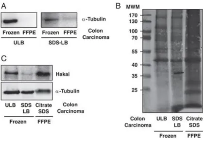 Figure  1.  Comparison  of  the  protein  extraction  protocols  from  fresh-frozen  and  FFPE  colon  carcinoma  tissues
