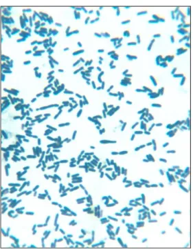 Figura  2.  Placa  petri  conteniendo  el  desarrollo  microbiano  y  algunas  colonias aisladas  del  desecho  pesquero  sanguaza  enriquecido  durante  5  días, dilución a 10 -10