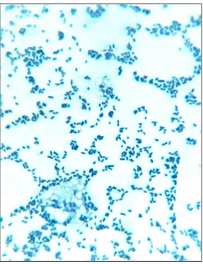 Figura  3.  Observación  microscópica  del  cultivo  axénico  1  aislado  del  desecho pesquero sanguaza