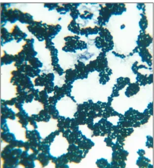 Figura  4.  Observación  microscópica  del  cultivo  axénico  2  aislado  del  desecho pesquero sanguaza
