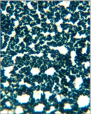 Figura  6.  Observación  microscópica  del  cultivo  axénico  4  aislado  del  desecho pesquero sanguaza