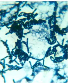 Figura  8.  Observación  microscópica  del  cultivo  axénico  6  aislado  del  desecho pesquero sanguaza