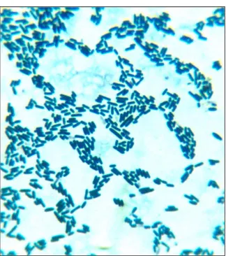 Figura  9.  Observación  microscópica  del  cultivo  axénico  7  aislado  del  desecho pesquero sanguaza