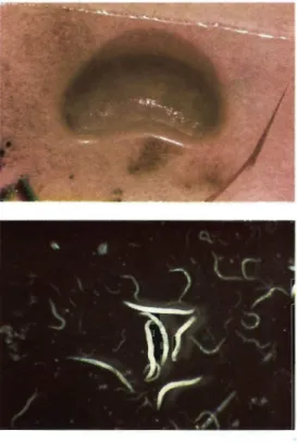Fig. 2. Nematodo Steinernema sp.
