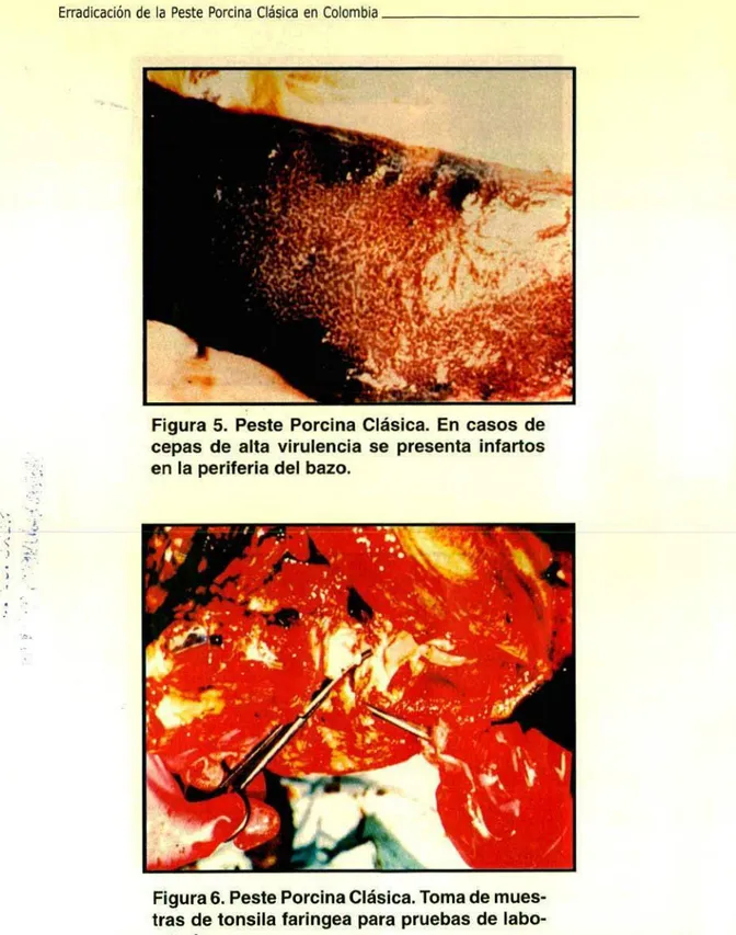 Figura 5. Peste Porcina Clásica. En casos de cepas de alta virulencia se presenta infartos en la periferia del bazo.