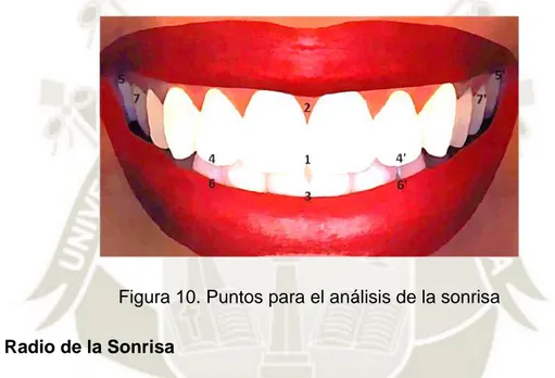 Figura 10. Puntos para el análisis de la sonrisa c.1 Radio de la Sonrisa