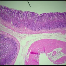 Figura  4.  Mucosa  gástrica  de  Rattus  rattus  var.  albinus  del  grupo  I  que  recibió  inyección  de  solución  salina  fisiológica