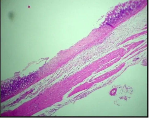 Figura 6. Mucosa gástrica (cuerpo) de Rattus rattus var. albinus del  grupo III que recibió una dosis de papa, y etanol (10x)