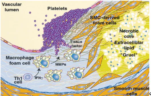 Figura 4.  Papel  de  las  CML  y  los  macrófagos  derivadas  de  las  células 