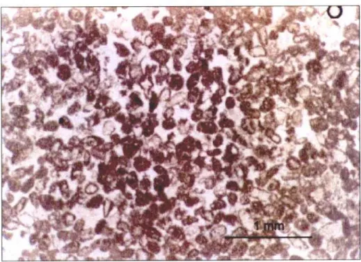 Foto 14. Detalle a microscopio de los microfósiles de la Caliza masiva,