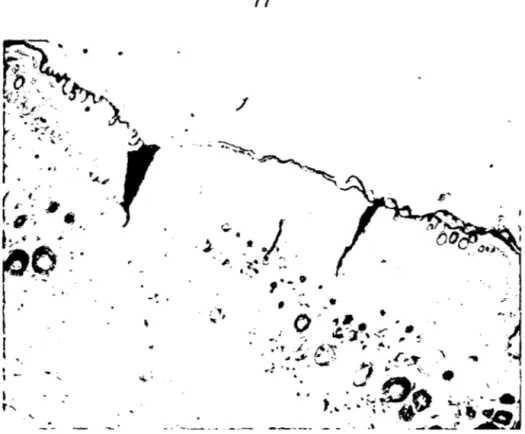 Figura 7 Fotomicrografia de piel de cuy de la fase 2 y 3 de la cicatrizacion;  se  aprecia usencia de foliculos pilosos