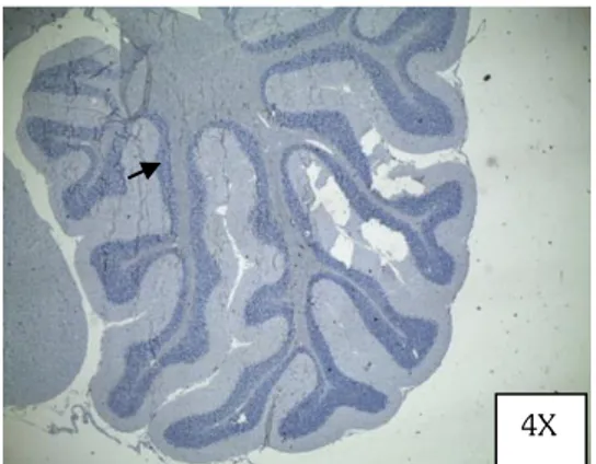 Fig.  2.  Determinación  la  concentración  optima  del  anticuerpo  anti  MT1  por  inmunohistoquímica  del  cerebelo  de  rata  Holtzman  como  control  positivo  para  el  receptor MT1 para melatonina (la coloración marrón es el cromógeno que precipita 