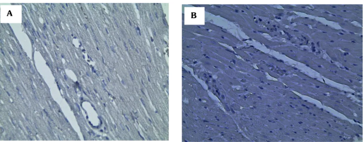 Fig. 3 Tejido cardiaco de rata Holtzman marcado con el anticuerpo anti MT1 receptor,  en A) sin endocarditis bacteriana y en B) con endocarditis bacteriana, observados a 40X 