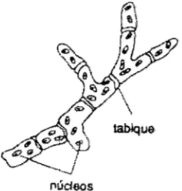 Figura W  1:  Hitas divididas en células multinucleadas 