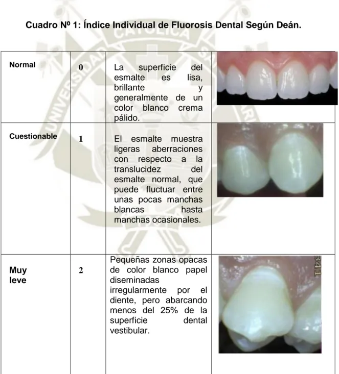 Cuadro Nº 1: Índice Individual de Fluorosis Dental Según Deán. 