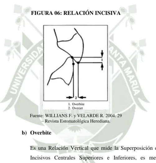 FIGURA 06: RELACIÓN INCISIVA 
