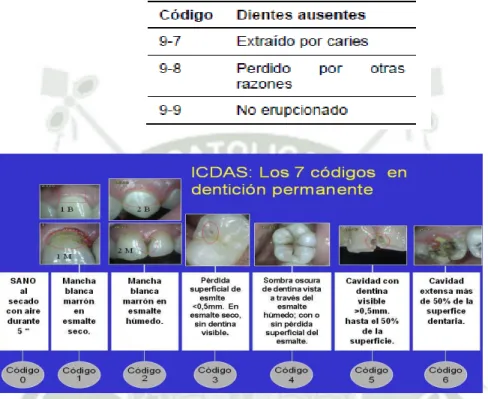 Figura 7: Códigos en dentición temporal según el Sistema internacional de Detección y Valoración  de Caries (ICDAS), Tomada de Criteria Manual   International Caries Detection and  Assessment System (ICDAS II)