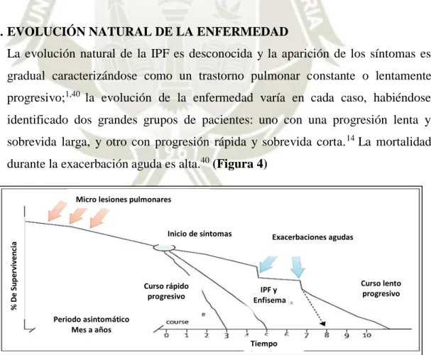 Figura 4. Fenotipos clínicos de la IPF. 1