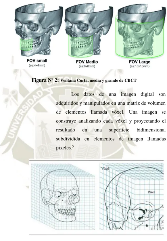 Figura Nº 3:  Diagrama de Vóxel (3D) Y Píxel (2D) 