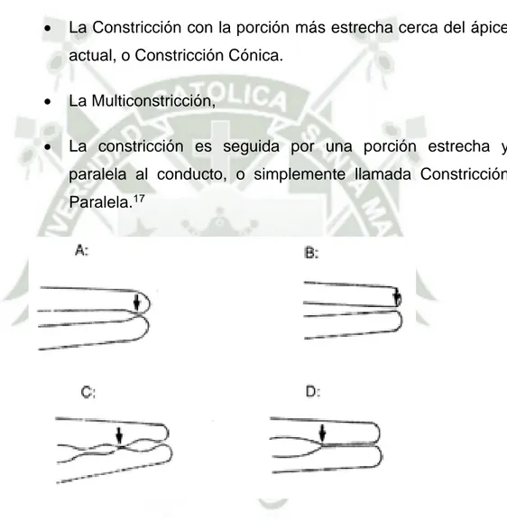 Fig. 2. Tomada de Dummer PM, McGinn J, Rees D. The position and  topography of the apical canal constriction and apical foramen