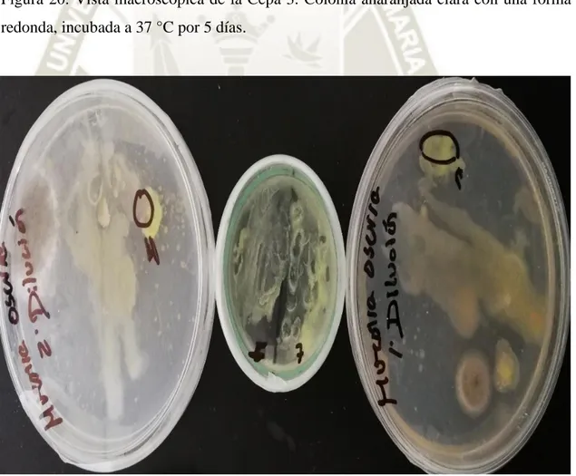 Figura 21. Vista macroscópica de la Cepa 4. Colonia transparente amarillo brillosa con  una forma ovalada, incubada a 37 °C por 5 días