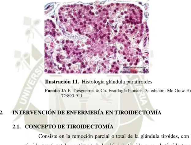 Ilustración 11.  Histología glándula paratiroides 