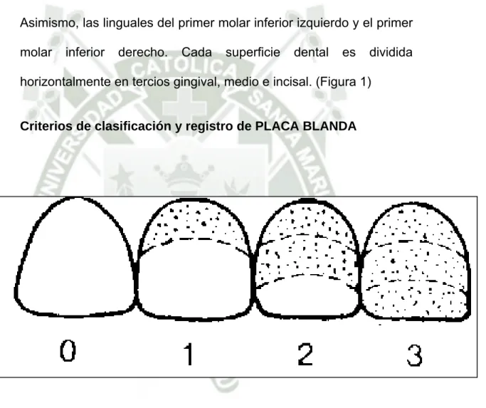Fig . 1   Fuente  HIGASHIRA 