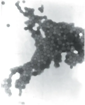 FIGURA 7: Microfotografías del latex Kollicoat MAE 30D obtenidas por TEM a pH 2.36.