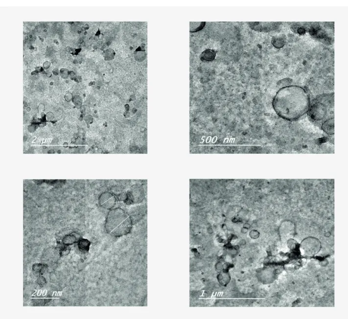 Figure 3: TEM images showing ALDS liposomes (F6) with different magnification scale.