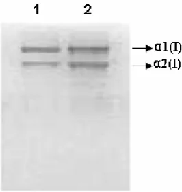 FIGURA 1. SDS – PAGE de colágeno tipo I de piel de tiburón. Calle 1: colágeno soluble en ácido  y Calle 2: colágeno soluble en pepsina.