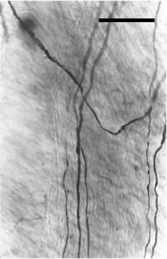 Fig. 3. Nervios perivasculares en el tabique interauricular.