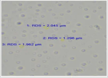 Figure  1.  Microphotograph  of  metoprolol  tartrate  loaded microspheres