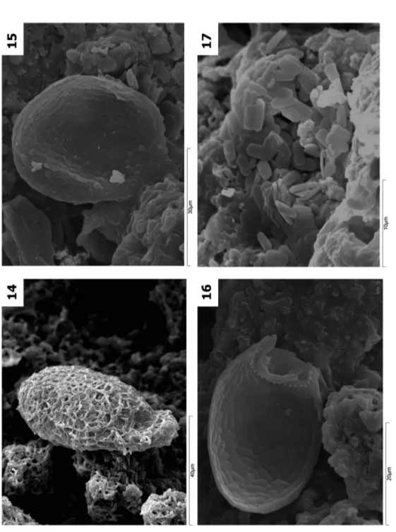 Fig. 14. Trinema sp. with cyanobacteria covering its test. Trapa, Galicia, Spain. Fig