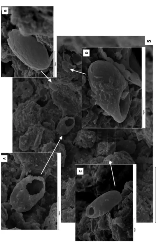 Fig. 5. Different species of testate amoebae. Porteliña, Galicia, Spain. A-C-D: Trinema linare; B: Euglypha rotunda
