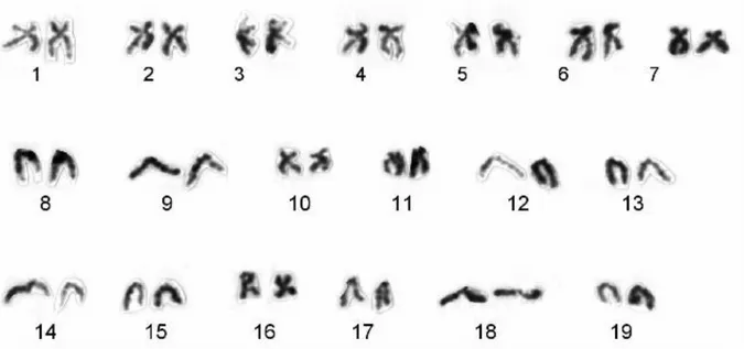Figure 3. Karyotype of Ensis siliqua (2n = 38) with nine telocentric chromosome pairs (# 8, 9, 12, 13, 14, 15, 17, 18  and 19).