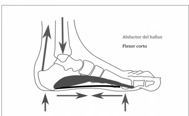 Figura 5. Algunos elementos activos encargados de mantener la estructura del arco.