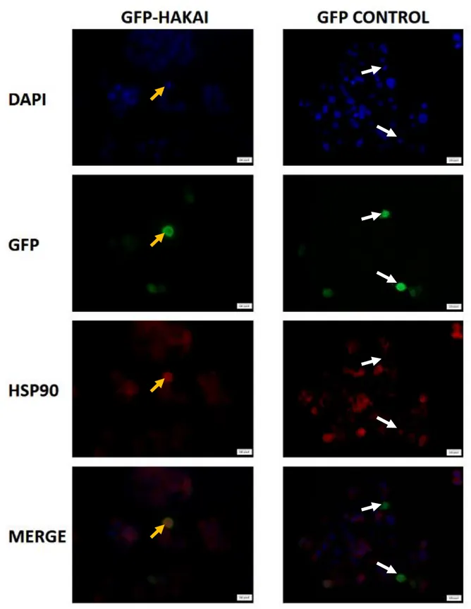 Figure  9.  Effect  of  GFP-Hakai  overexpression  on  Hsp90  in  LoVo  cells  by  immunofluorescence