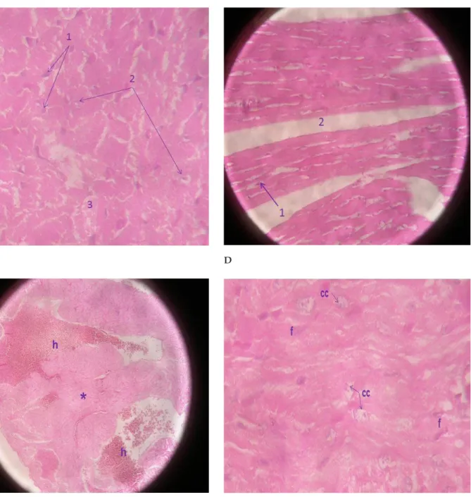 Figure 1. Representative micrographs of myocardium of rats fed the NW diet. (A) Micrograph of group NWNE myocardium at 400x