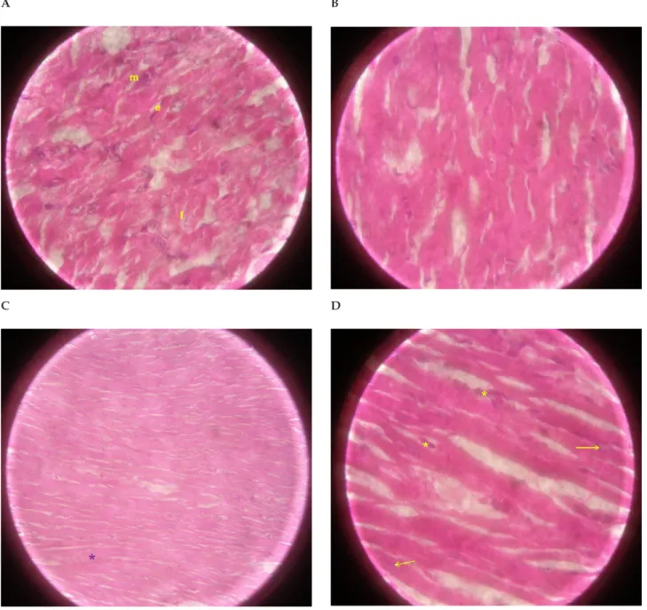 Figure 2. Representative micrographs of myocardium of rats fed the WG diet. (A) and (B) Micrographs of group WGNE at 1000 x